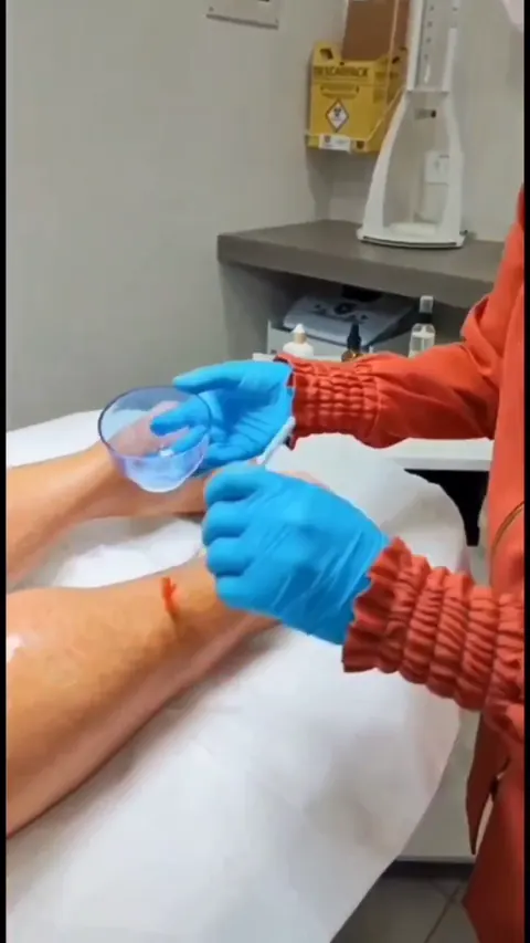 Frame real de atendimento na região das pernas, com mãos enluvadas.